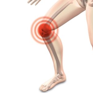 膝の痛みの原因を知り、膝に負担をかけないスクワットで予防している